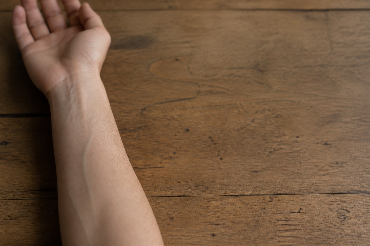 A bare forearm resting palm upward on a dark wooden table